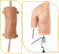 Arthroscopy