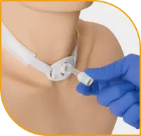 Tracheostomy