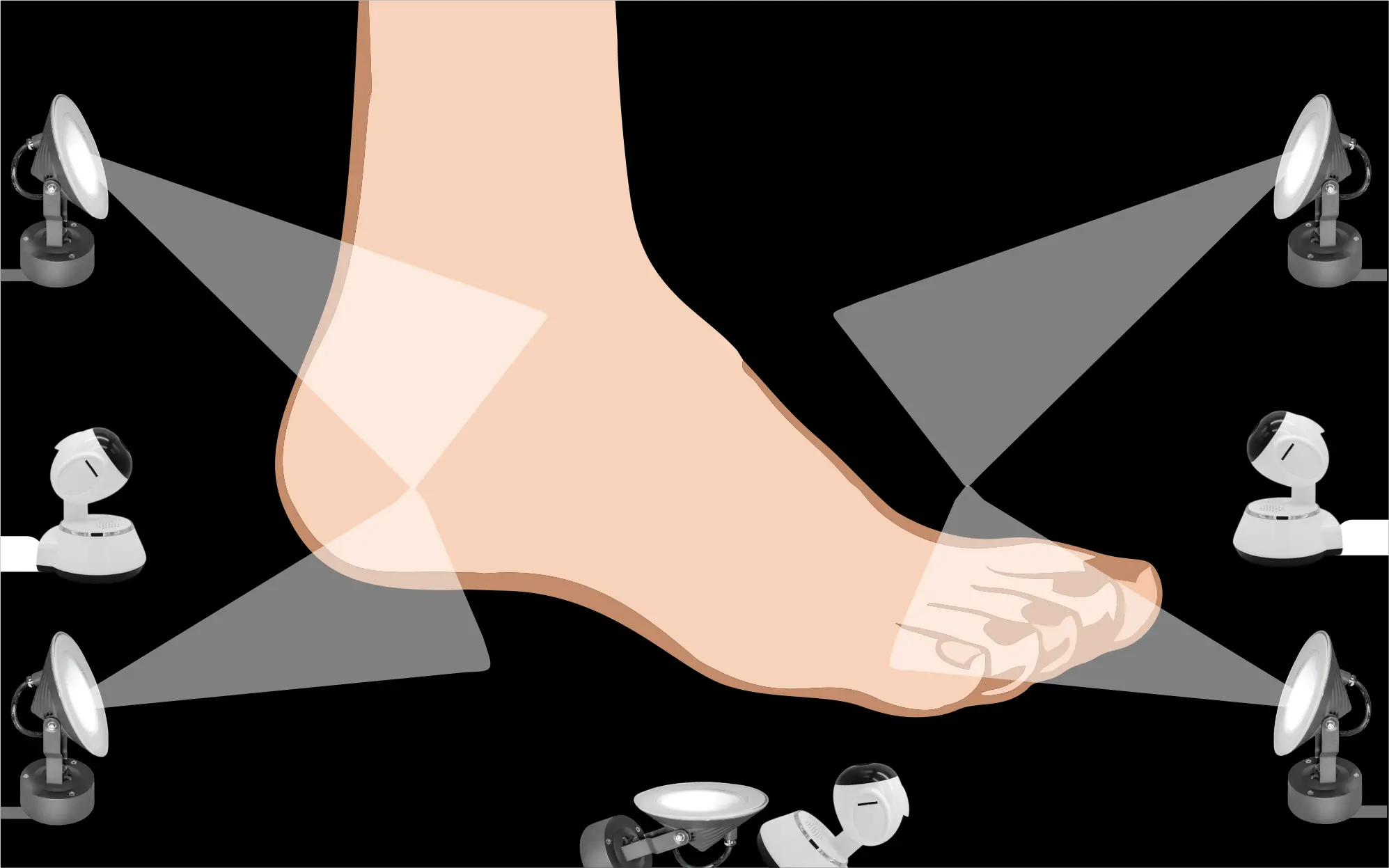 Diabetic Foot